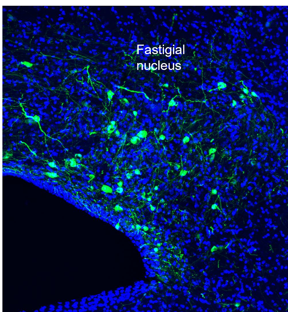 calca aav dio gfp image