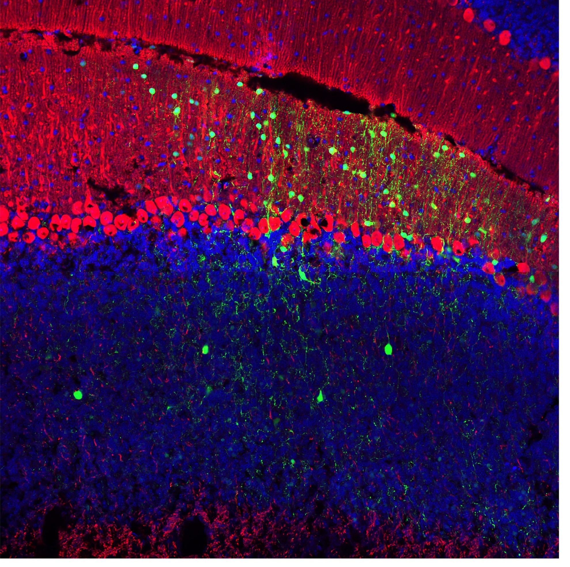 calca aav dio gfp calbindin Ab image