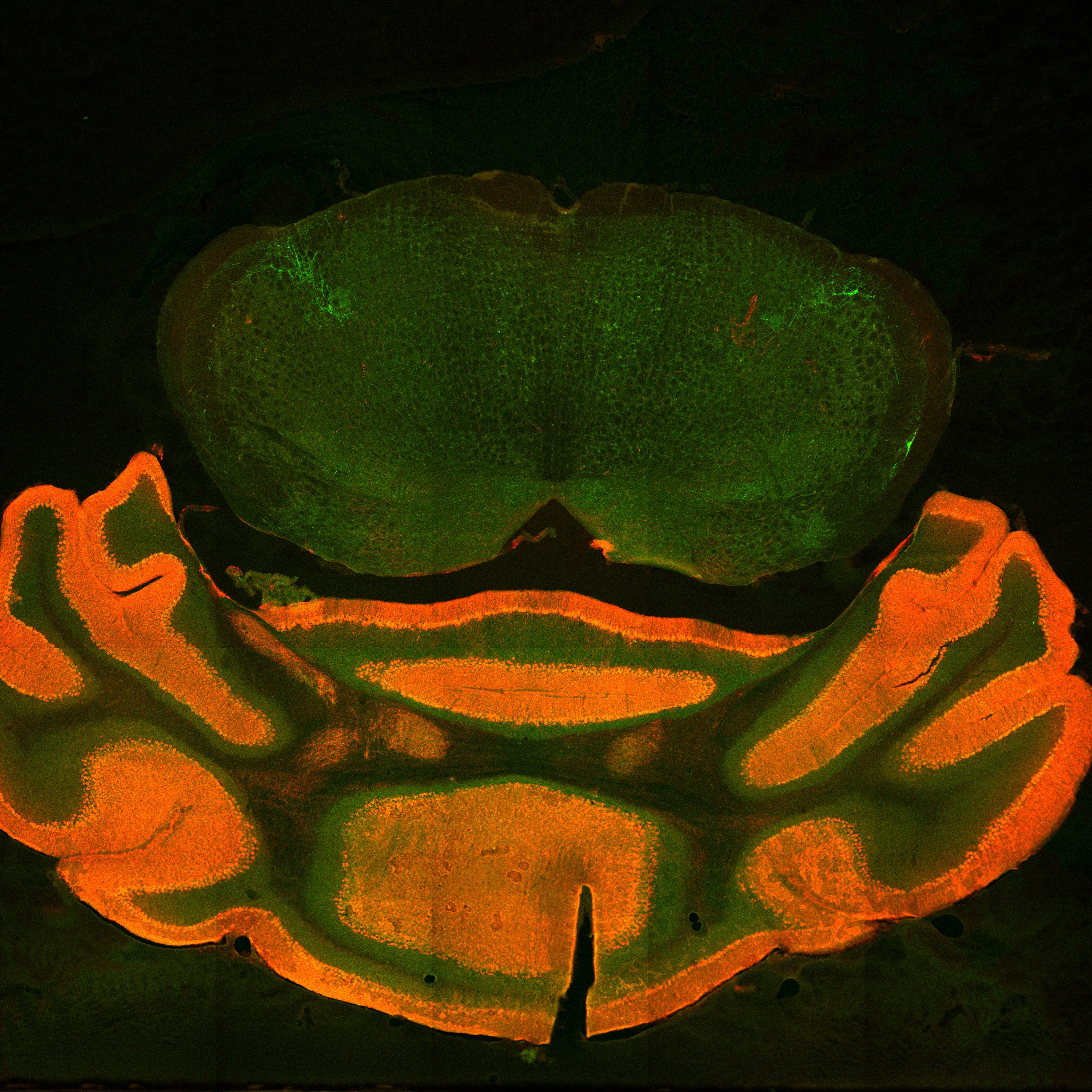 cb CGRP and clbindin image