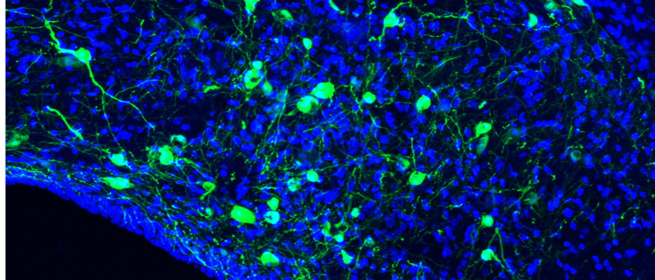calca aav dio gfp image