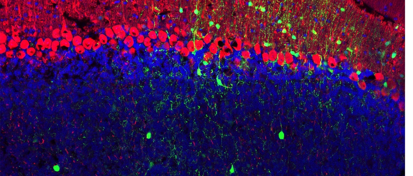 calca aav dio gfp calbindin Ab image