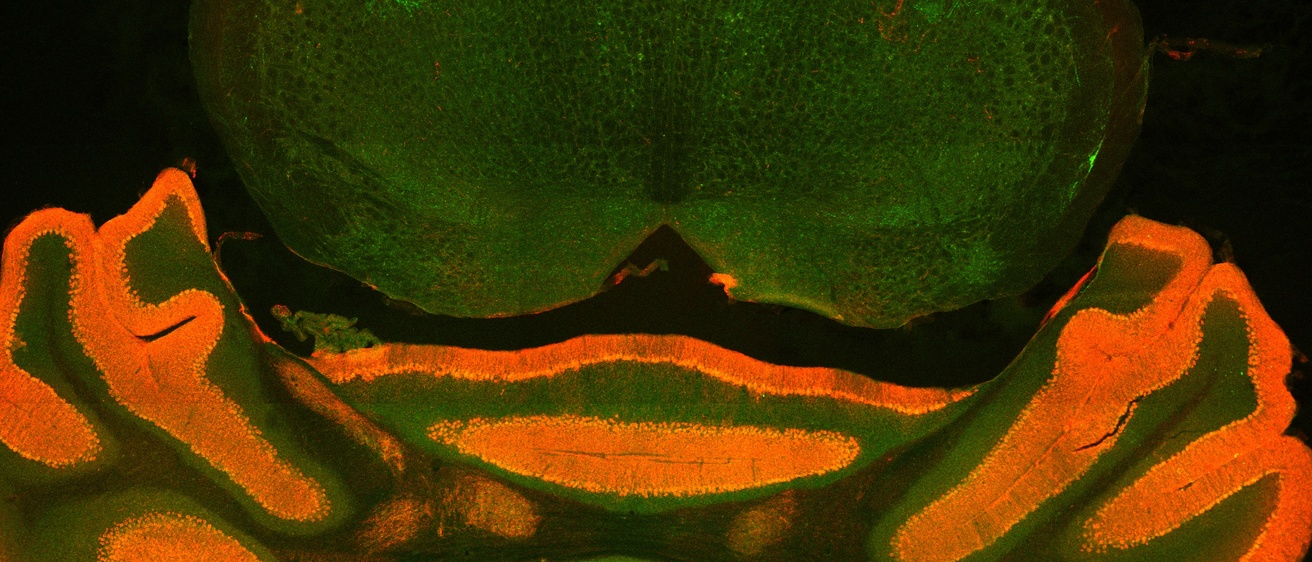 cb CGRP and clbindin image